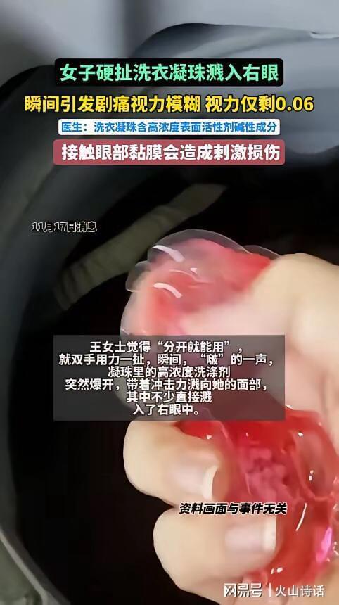 杭州一女子撕扯凝珠发生意外致眼睛失明瓦力棋牌游戏恐怖！洗衣引发“爆炸”(图2)